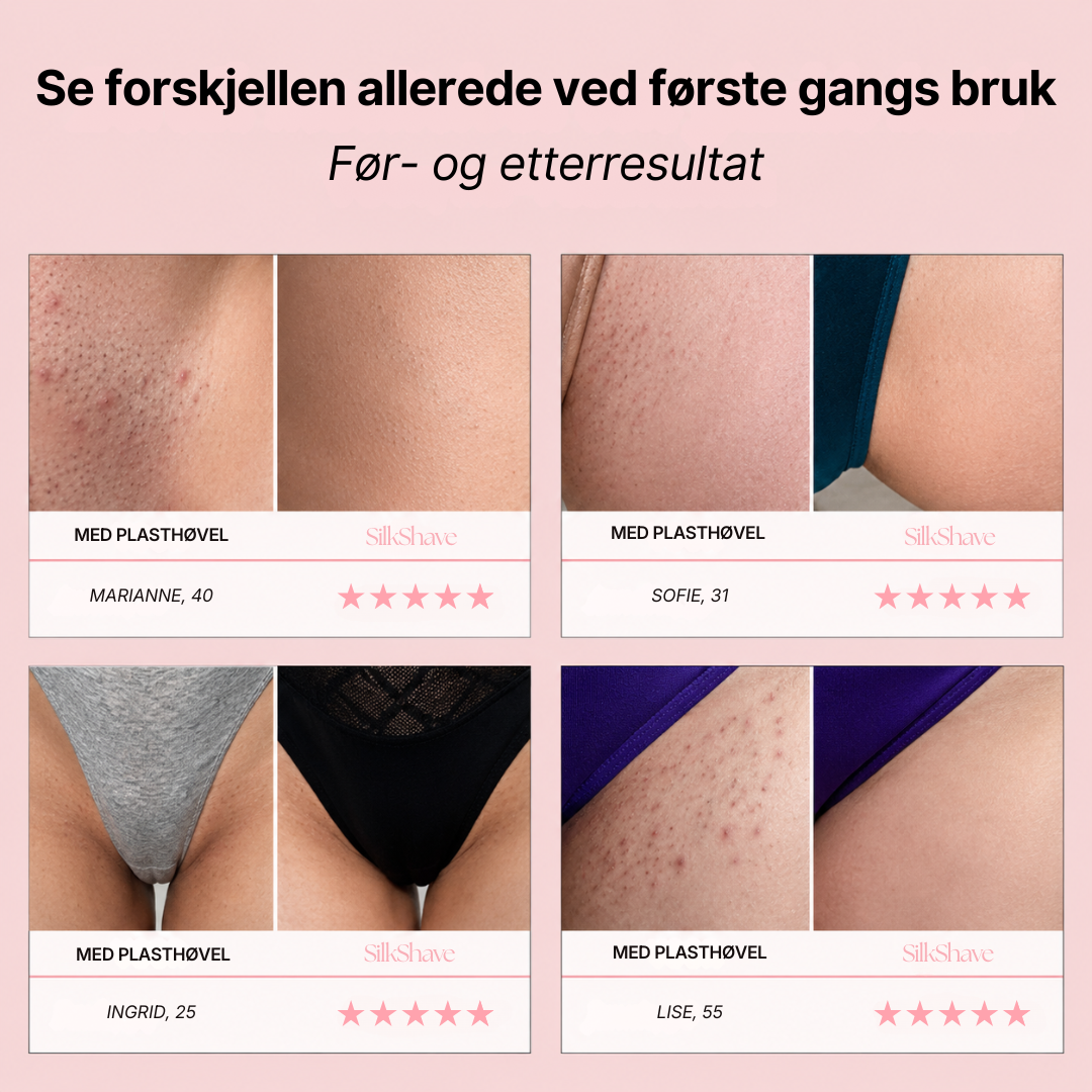 SilkShave - Silkemyk hud uten irritasjon