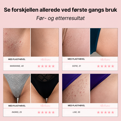 SilkShave - Silkemyk hud uten irritasjon